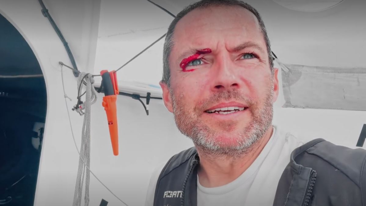 Une arcade ouverte pour Romain Attanasio sur le Vendée Globe Une arcade ouverte pour Romain Attanasio sur le Vendée Globe